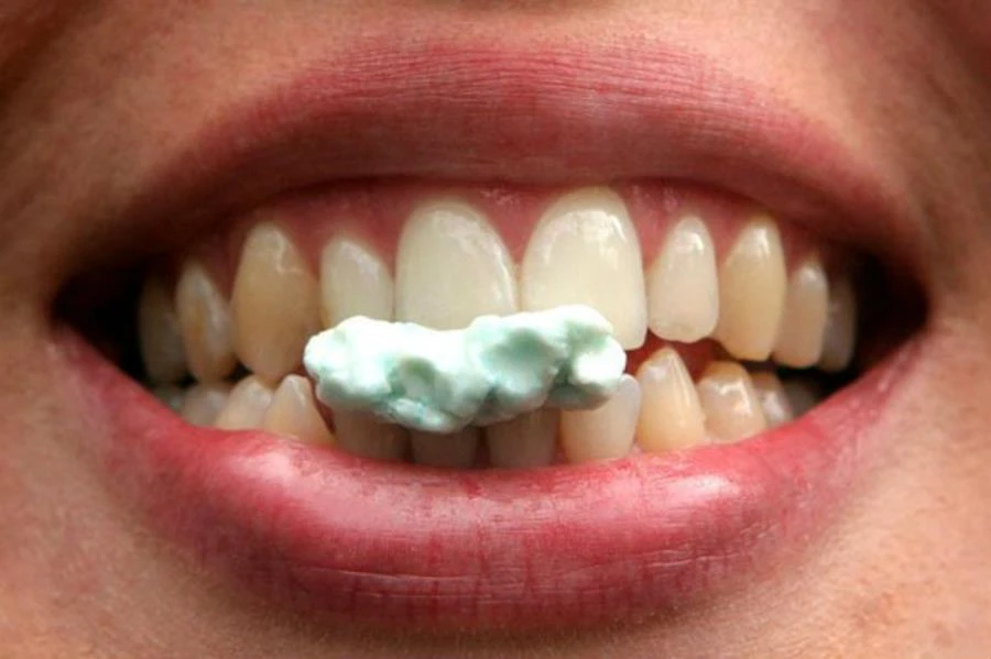 Le chewing-gum sans sucre est-il bon pour les dents ? - Edition du